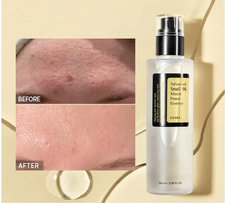 COSRX – Essence Mucin d’Escargot 96% | Hydratation & Réparation Intense