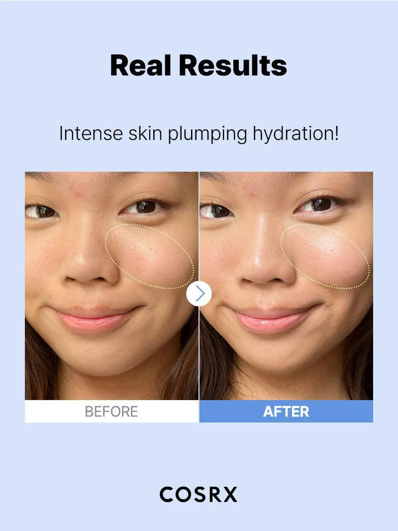 COSRX – Hyaluronic Acid Intensive Cream